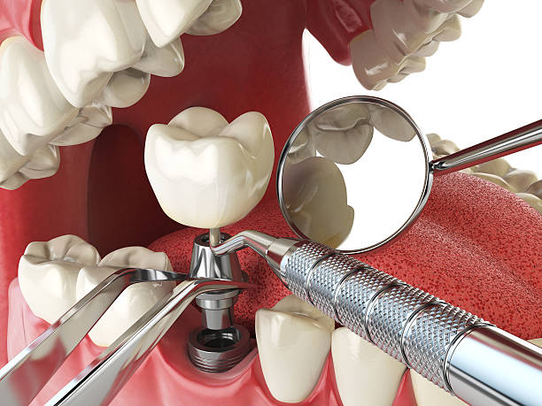 Best Orthodontic Emergency Dentist in Kingston Springs, TN